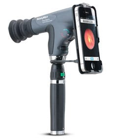 Welch Allyn iExaminer 6 - Adapter for iPhone 6 and 6s - 11840-A6